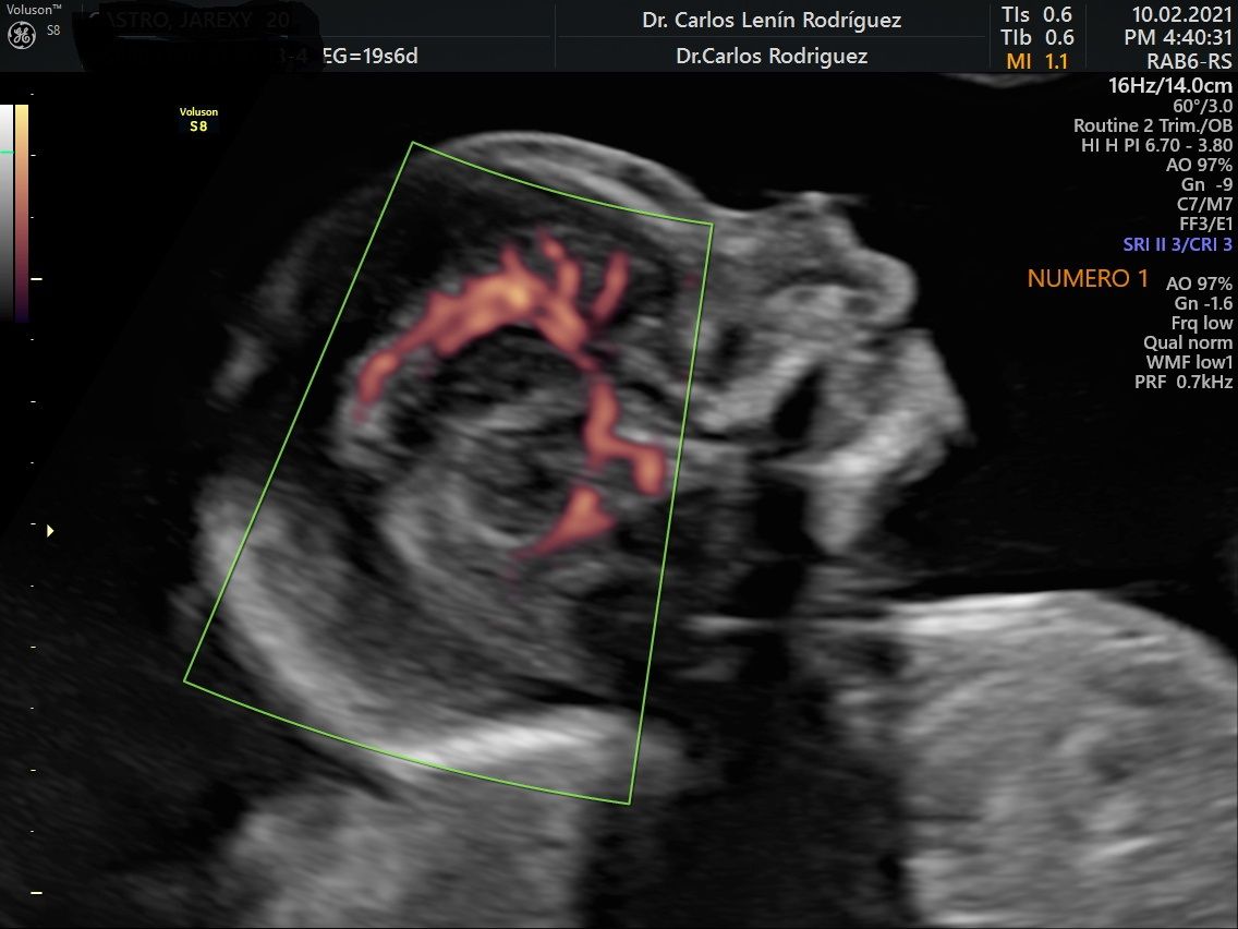 Carlos Lenin Rodriguez Mora-10