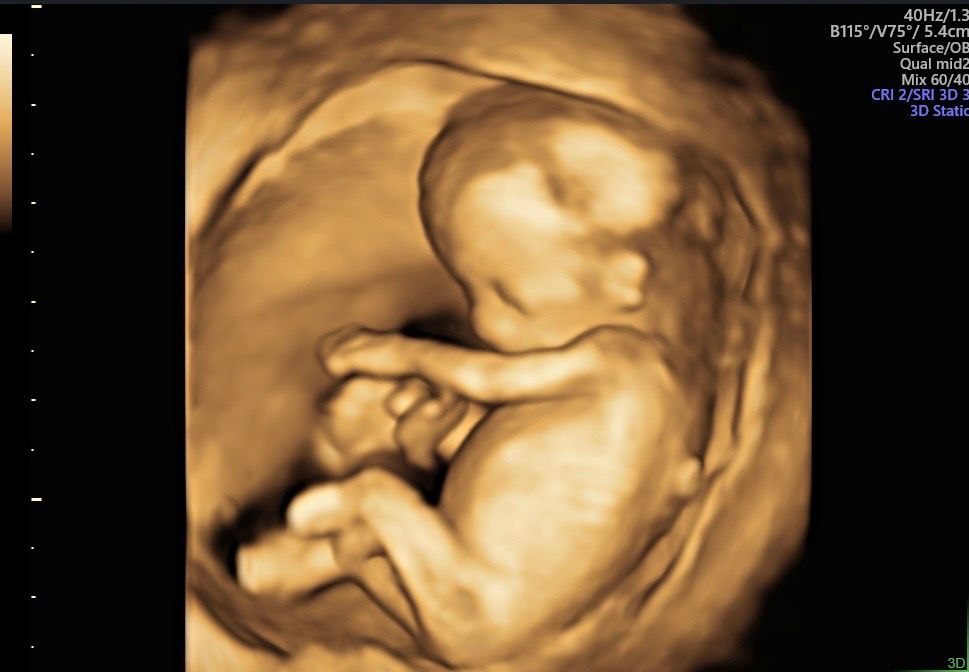 Martín Francisco Pérez Peña-5