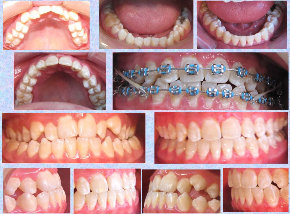 Ma. Elisa Duron Urtado-0