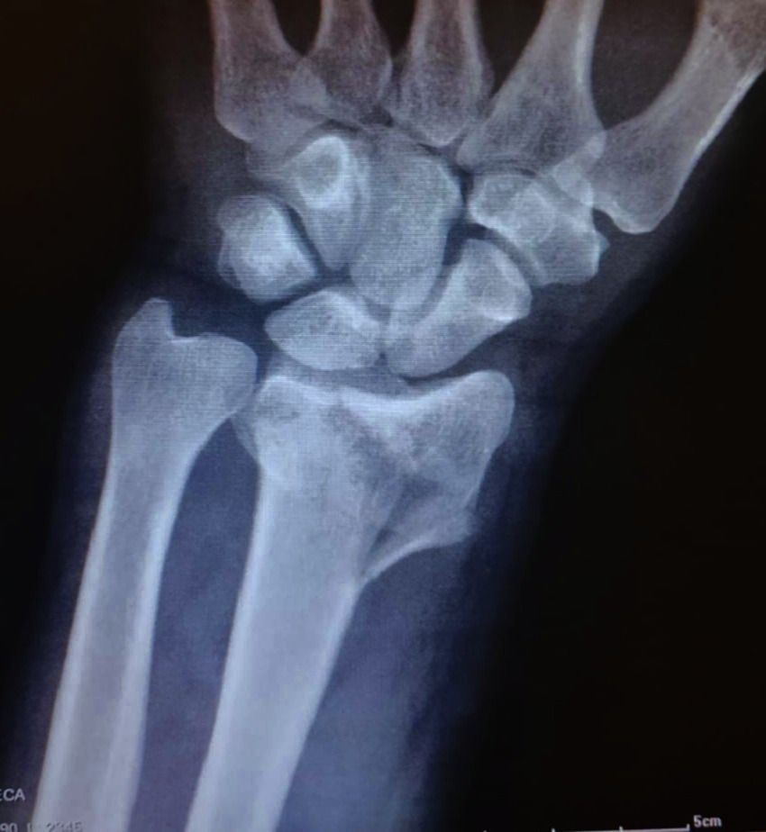 Rubén Rodriguez Acosta-0