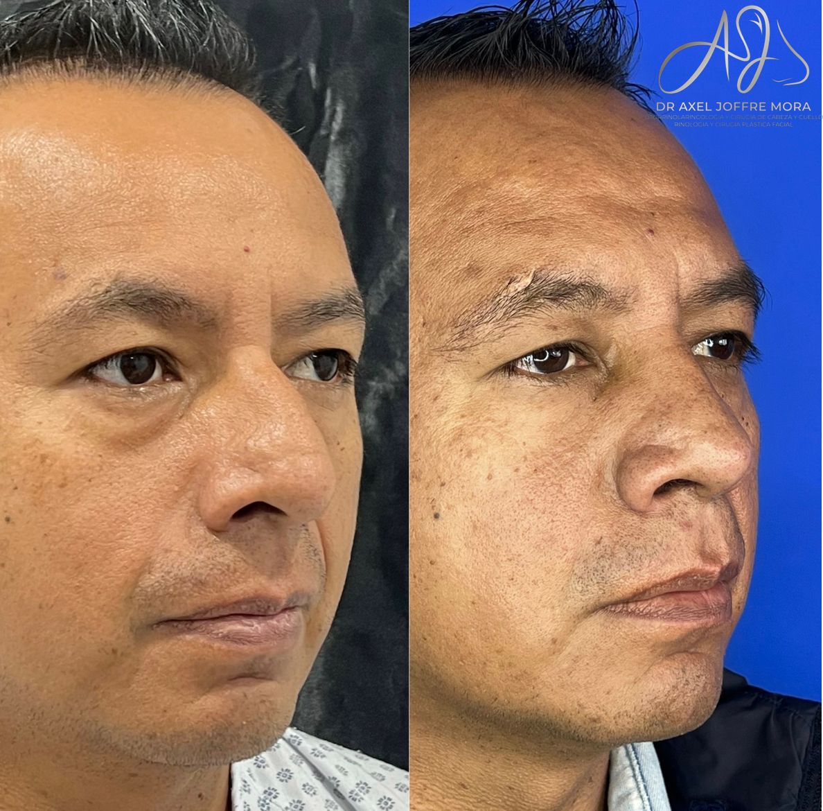 Axel Joffre Mora-140