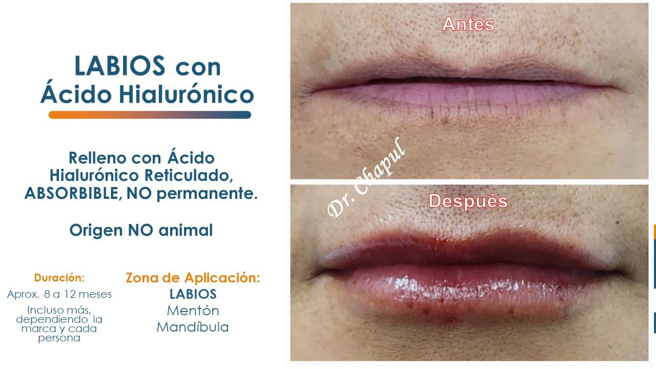 José Luis Muñoz Chapul-4