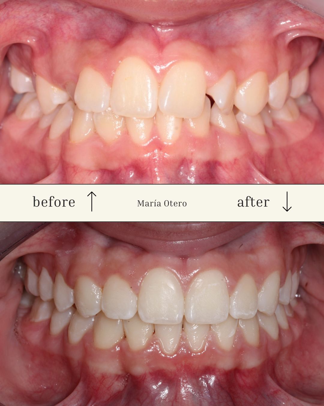 Maria Jesus Otero Lois-12