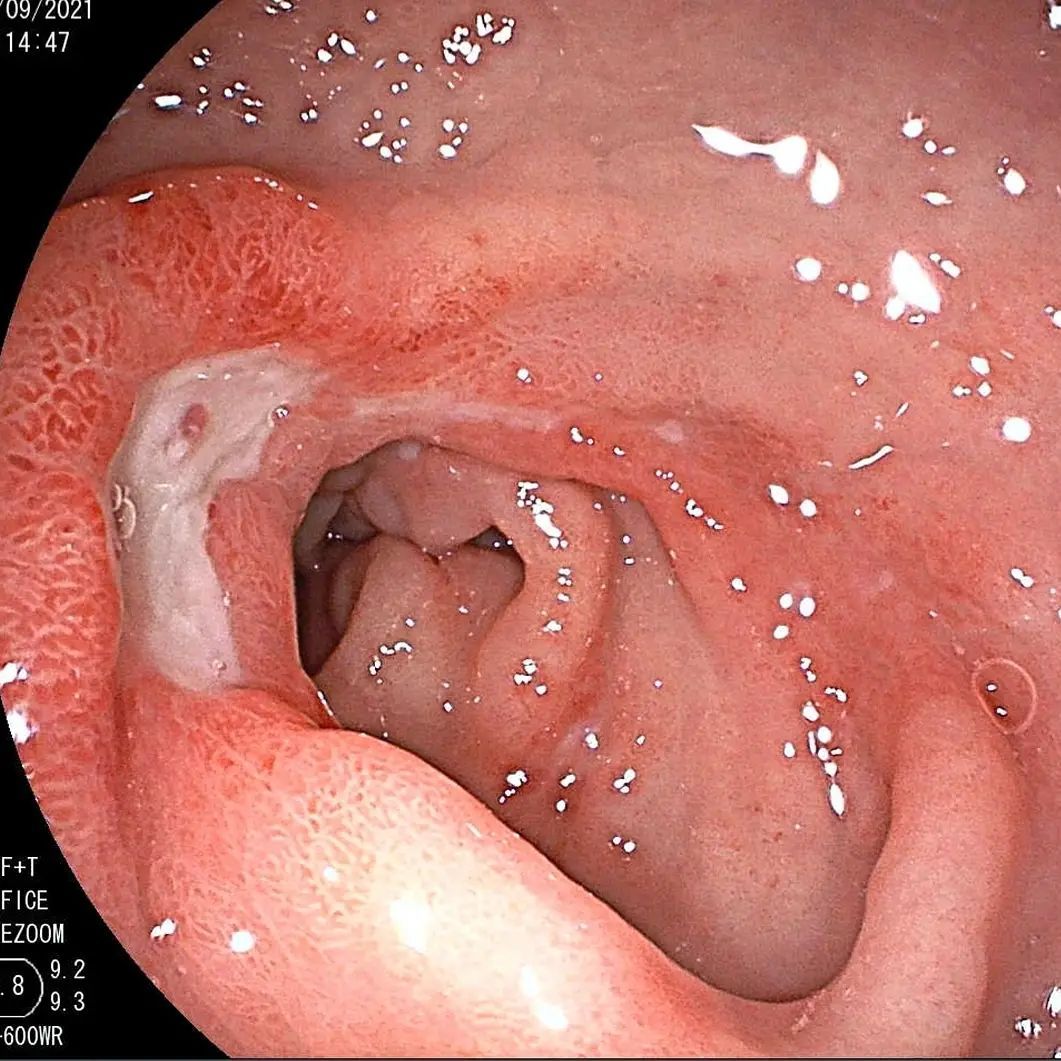 Edgar Alan De León Rojas-21