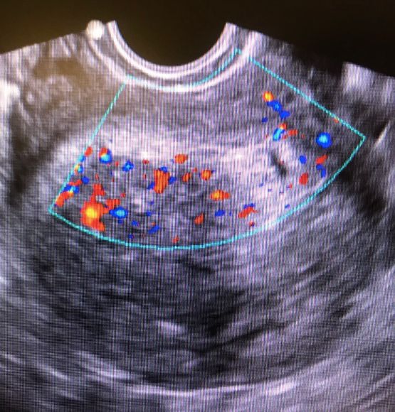 Griselda Reyes Torres-105