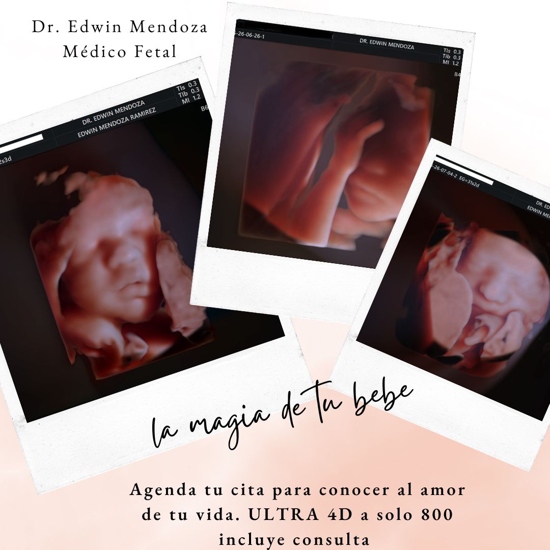 Edwin Mendoza Ramirez-2
