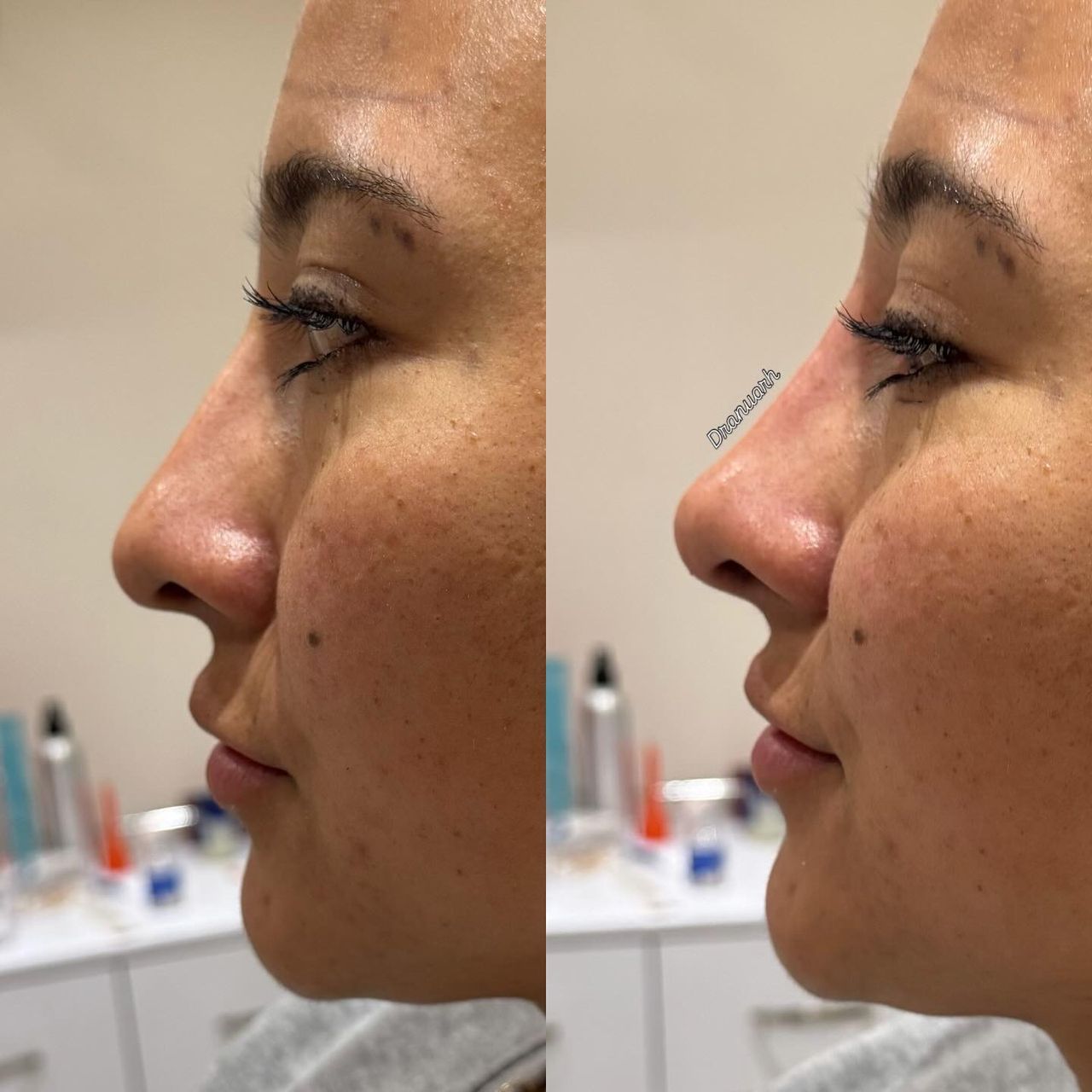 Anuar Hernández Flores-21