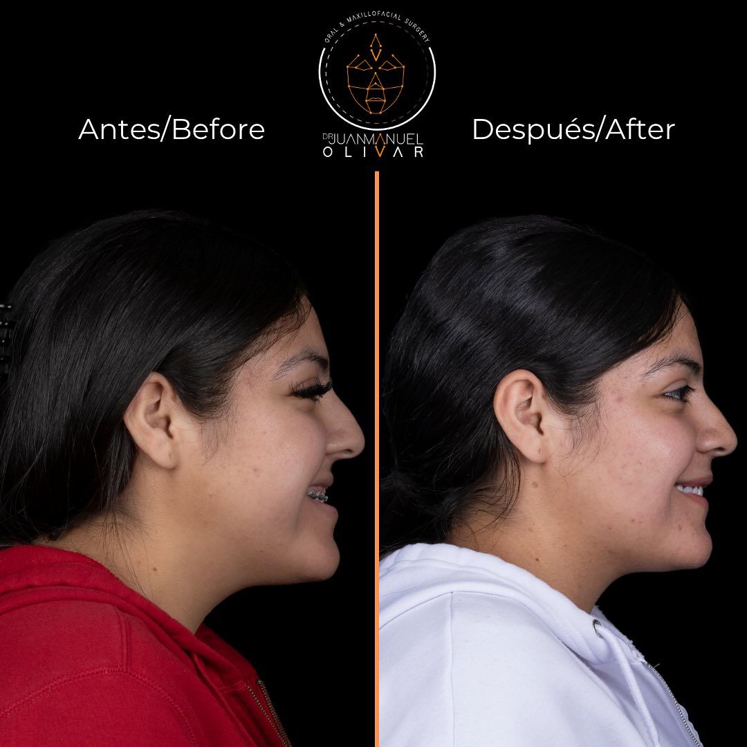 Juan Manuel Olivar Cedeño-4