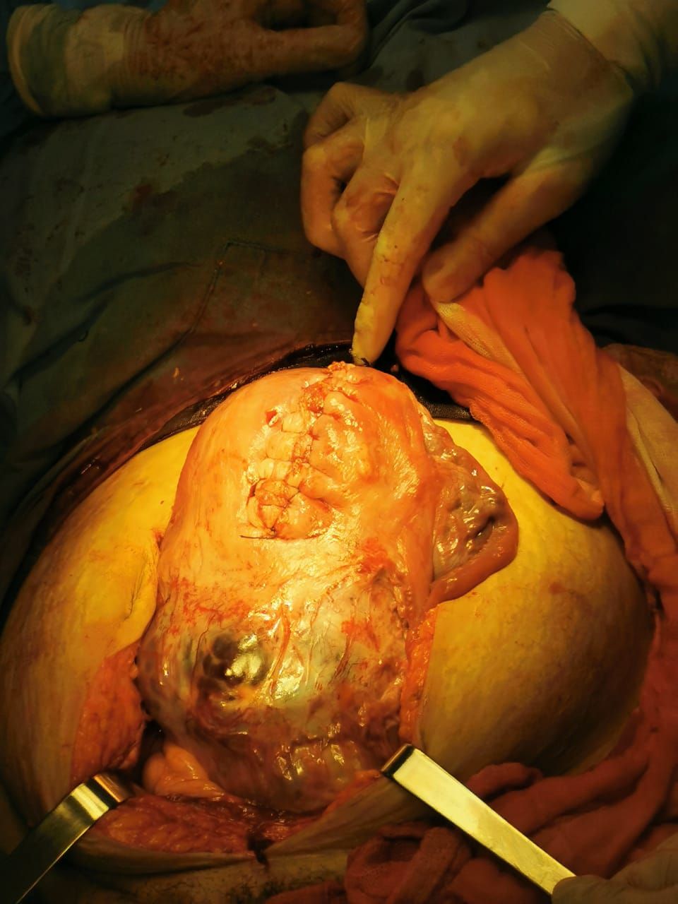 Brenda Anaid Torres Ugalde-9