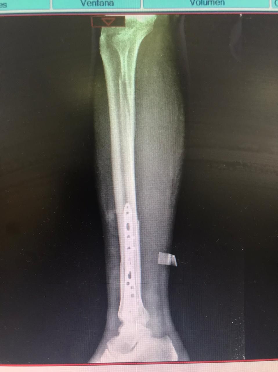 Juan José Luévano De La Cruz-48