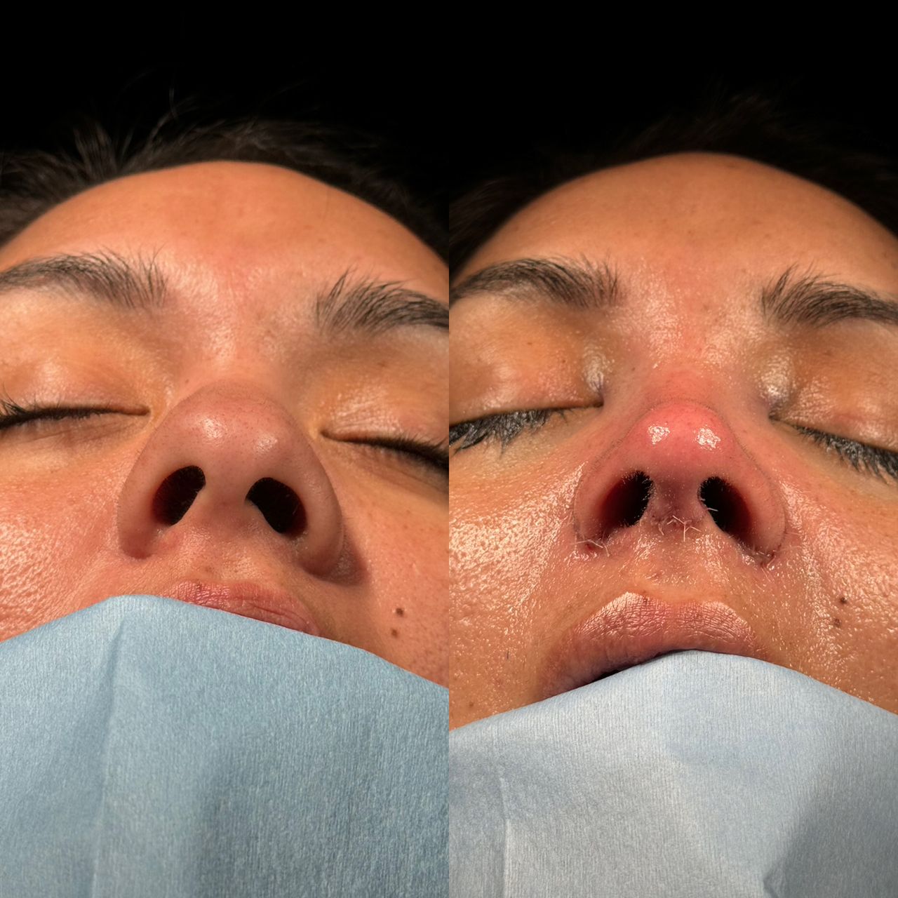 Angel Castro Urquizo-111