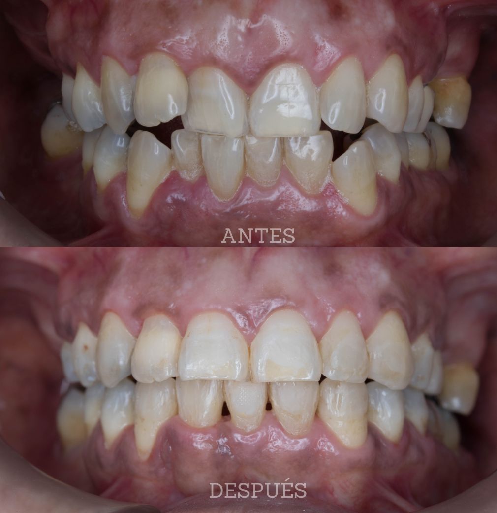 Yalile Talamas Troyo-9