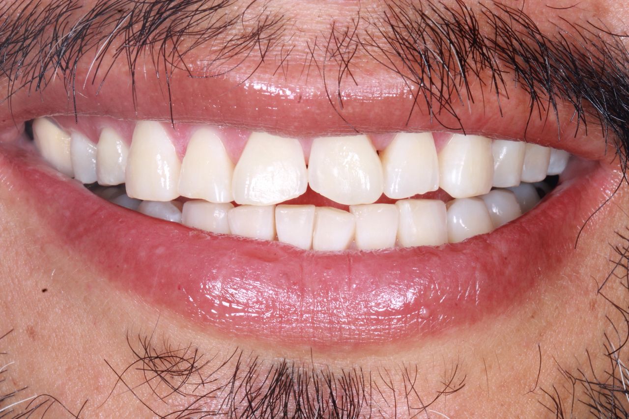 Heidi Mendoza Malagón-25