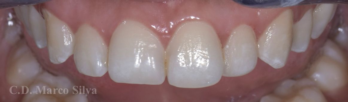 Marco Antonio Silva-5