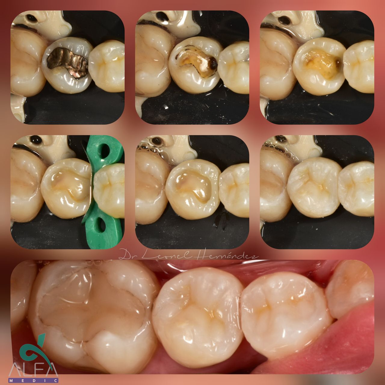 Leonel Hernández Gómez-23