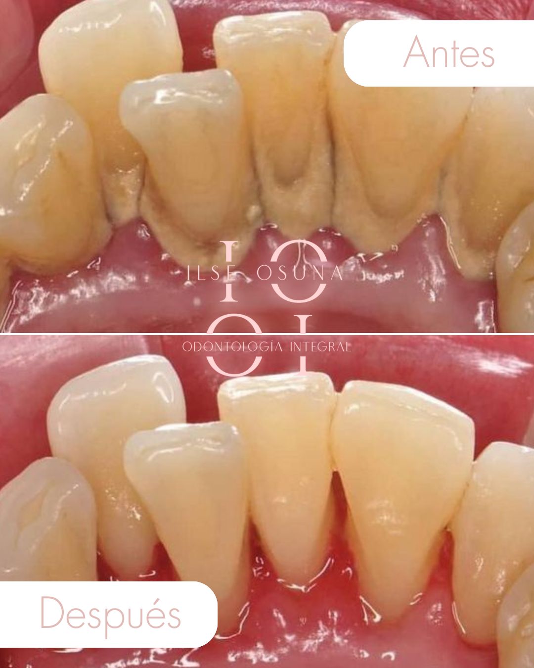 Ilse Valeria Osuna Rodríguez-14