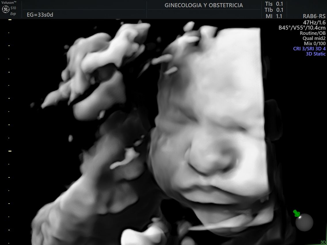 Juan Jose Pacheco Uc-7