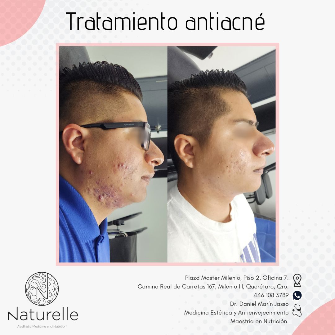 Daniel Marín Jasso-7