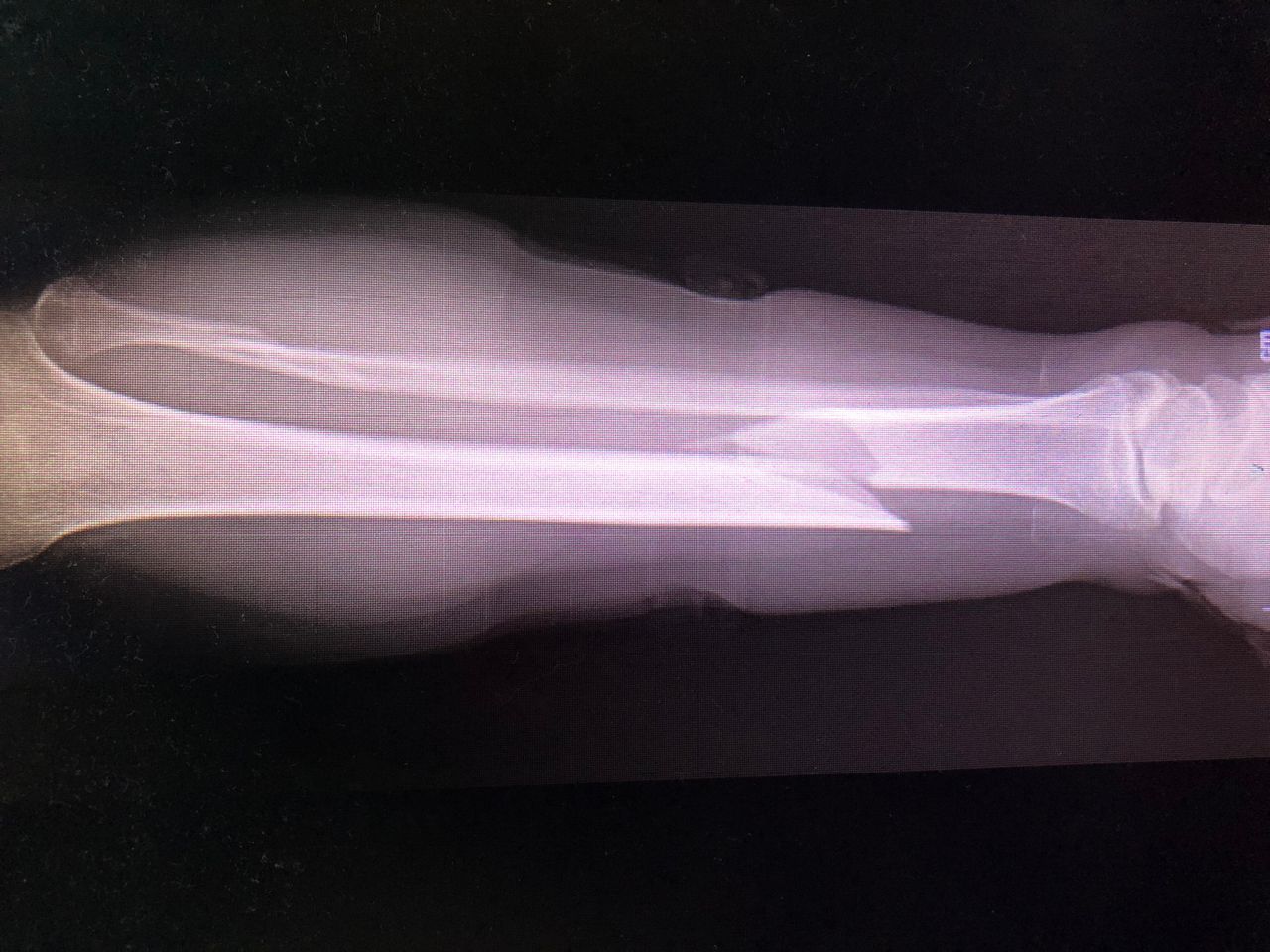 Alejandro Álvarez Colín-8