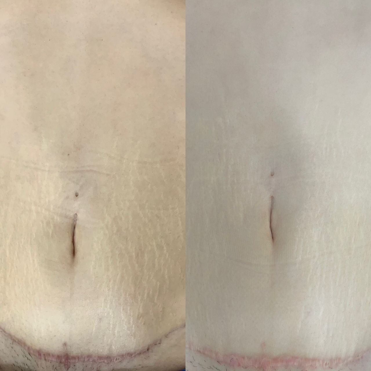 Carlos Rene Guerrero Acero-7