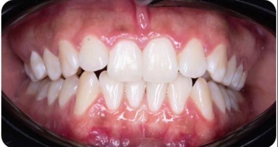 Vicente Emmanuel Silva Rangel-11