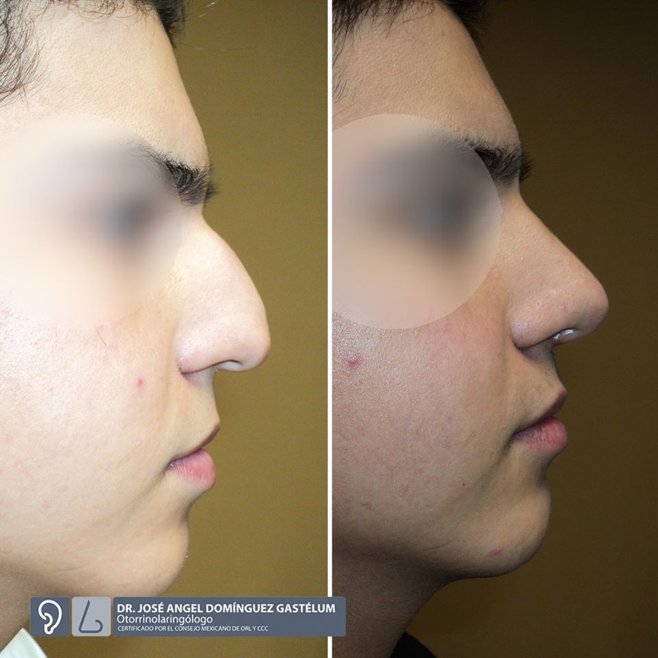 Jose Angel Dominguez Gastelum-6