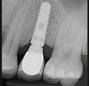 Ernesto Rojas Calderon-41