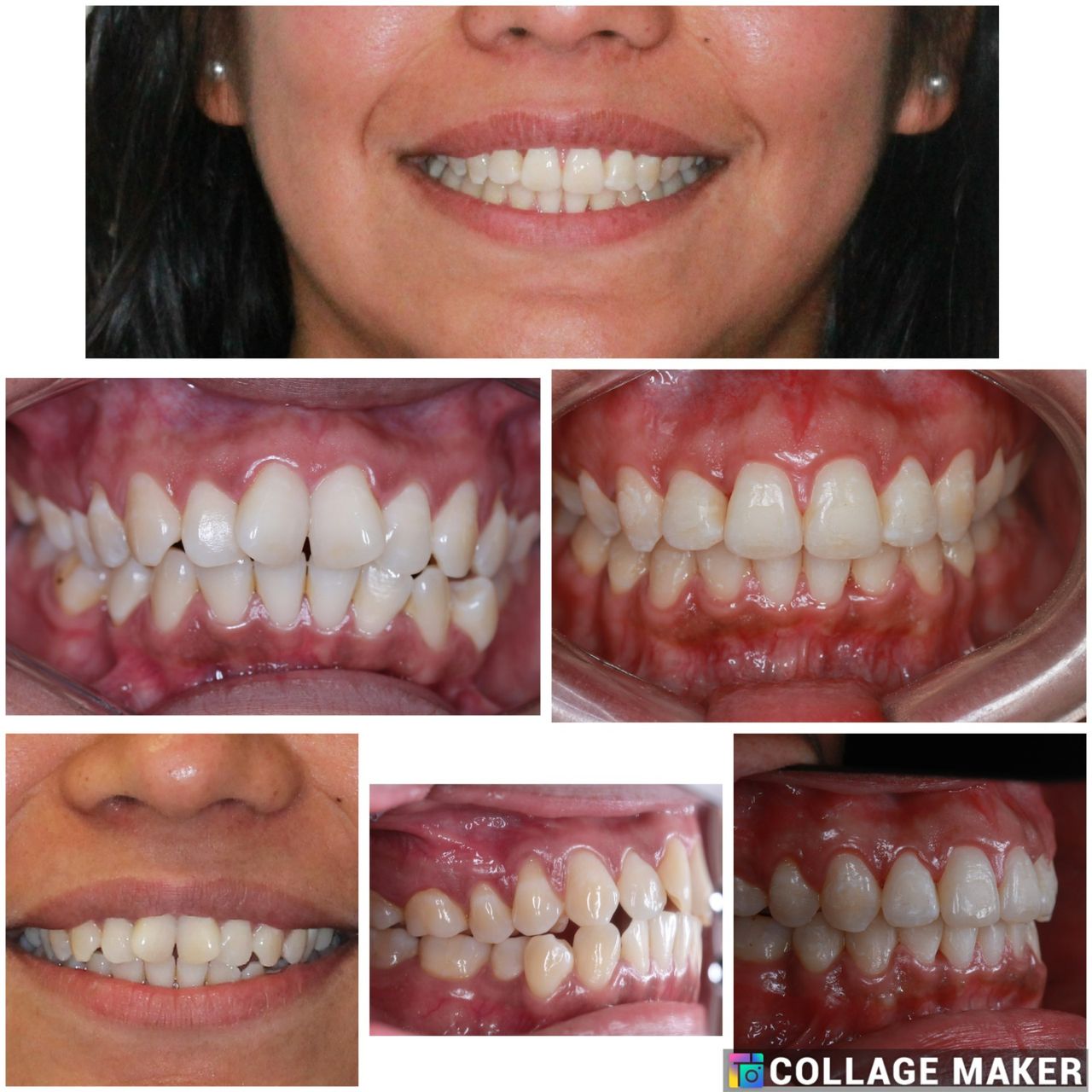 Ryan Michael Brenes Pacheco-2