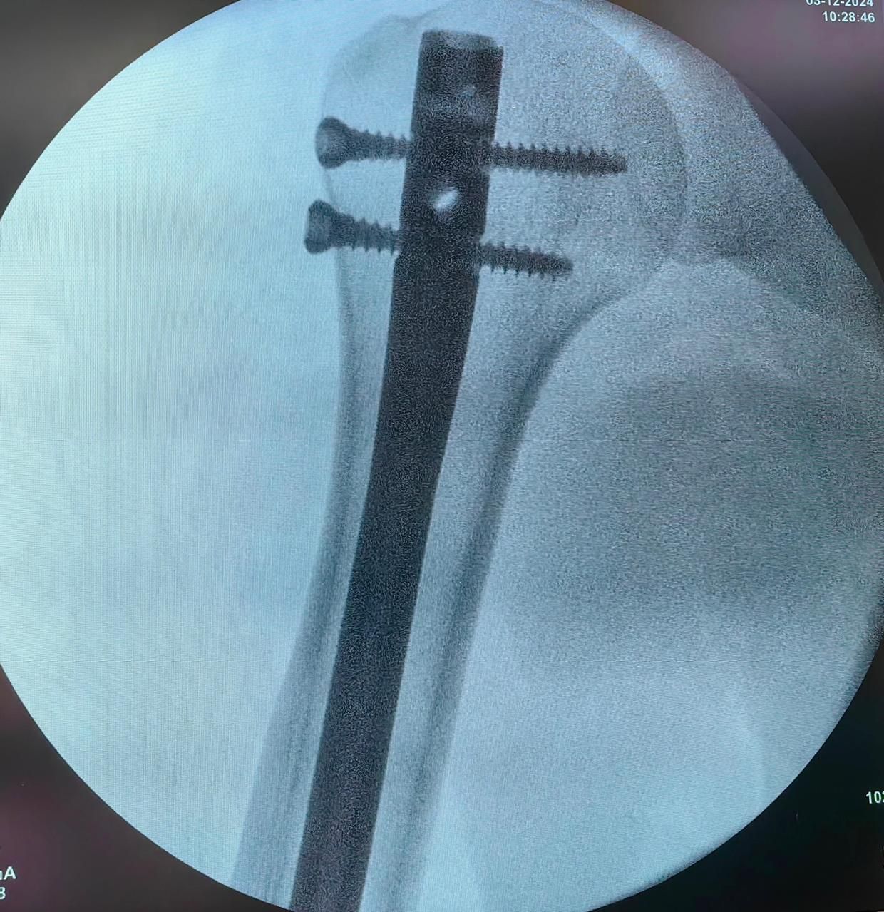 Juan Pedro Martínez Ávila-4