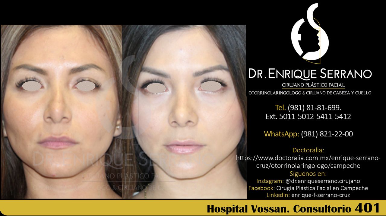 Enrique Serrano Cruz-110