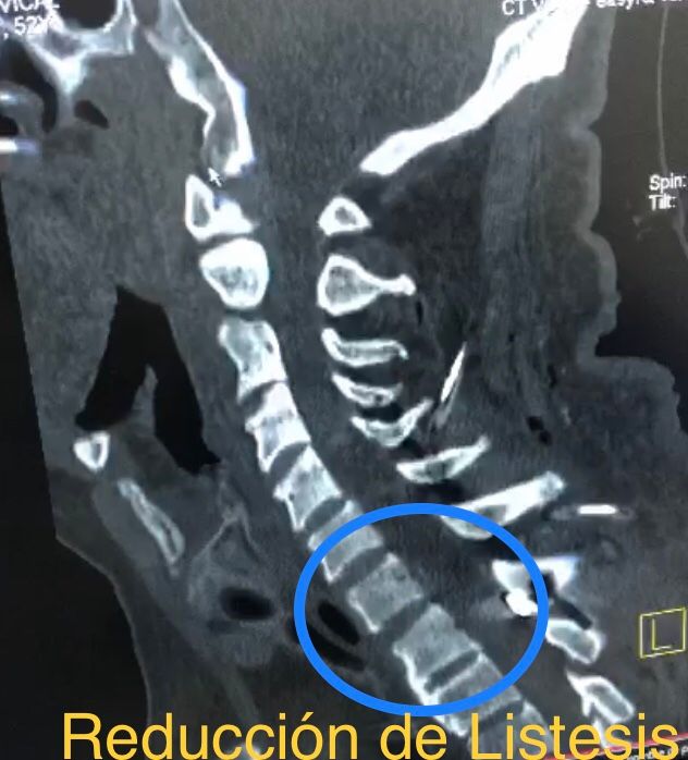 Rafael Maciel Morfin-51