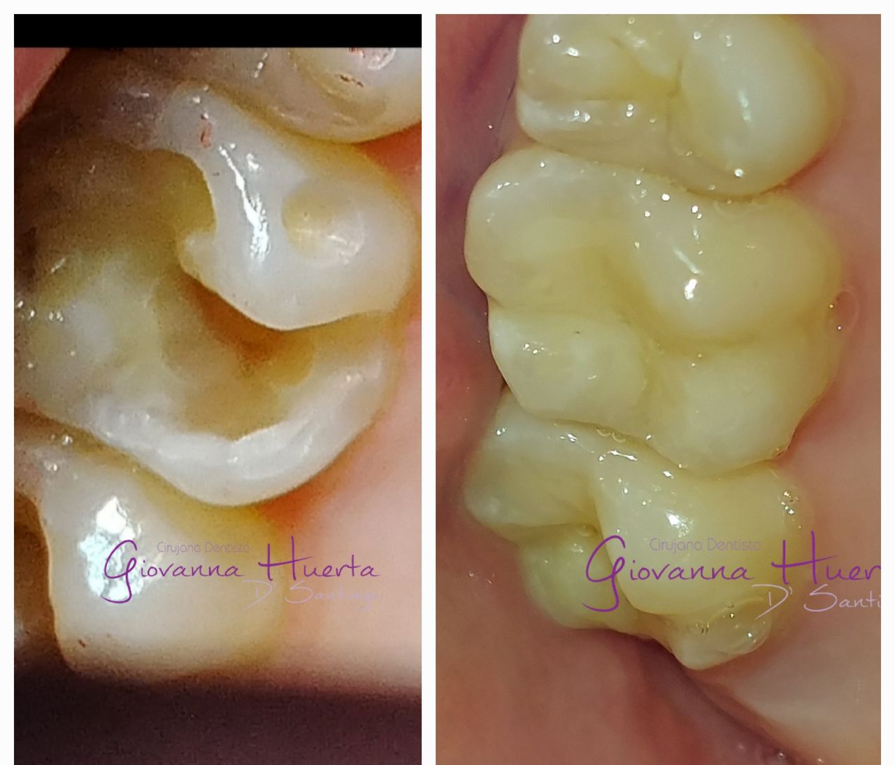 Giovanna Paola Huerta De Santiago-4