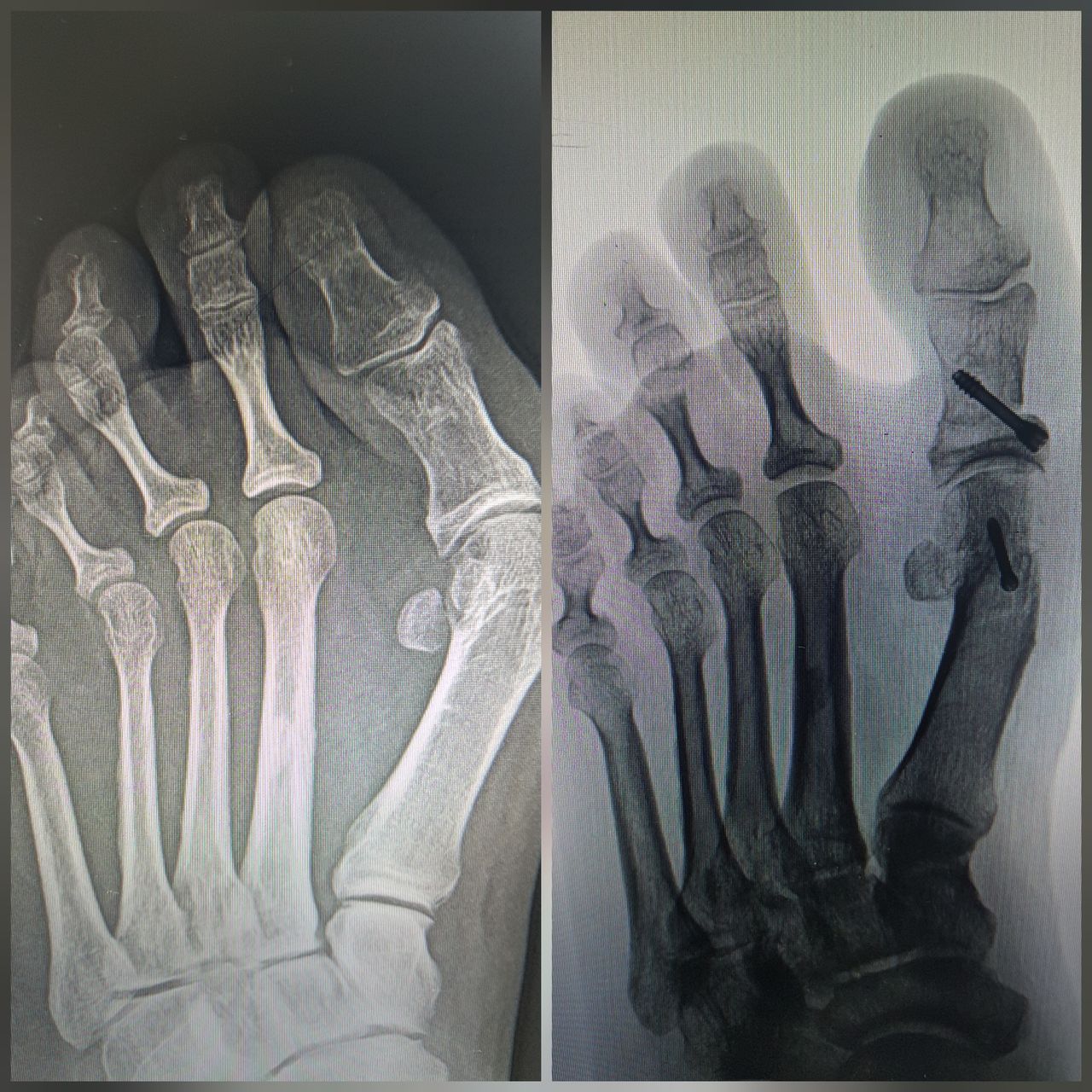 Alan Giovanni Polanco-7