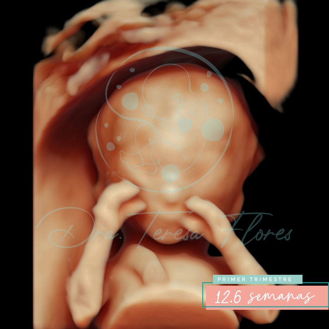 Teresa Miriam Flores Amador-6