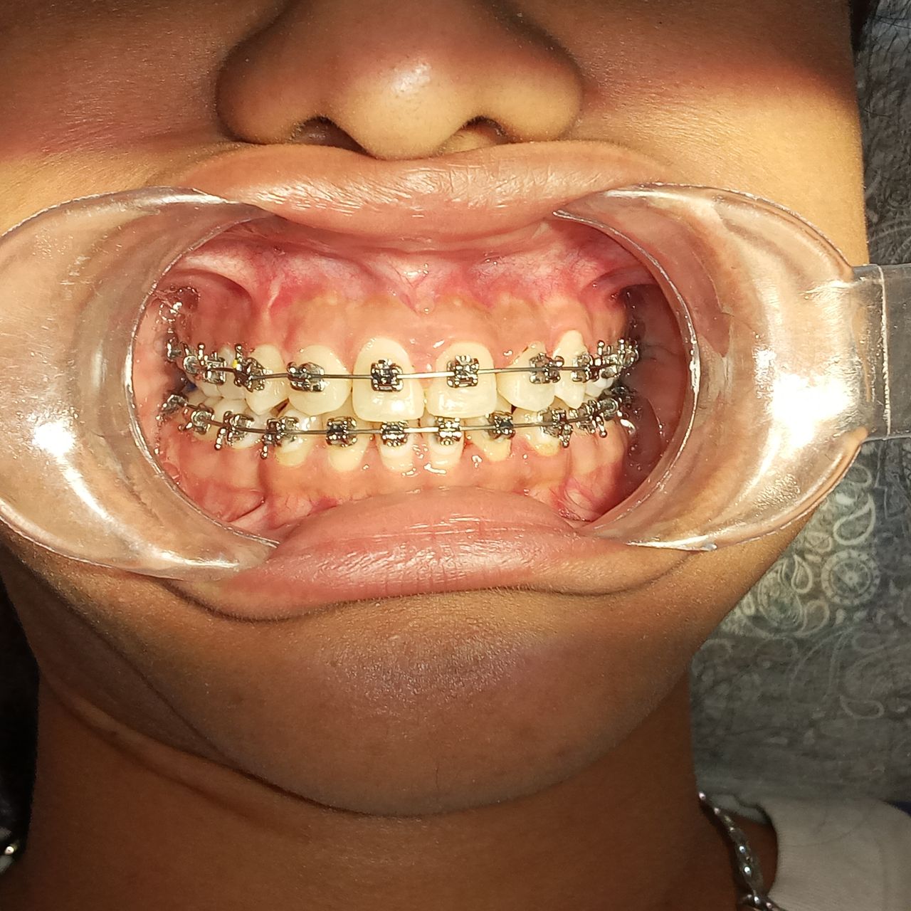 Giovanna Paola Huerta De Santiago-23