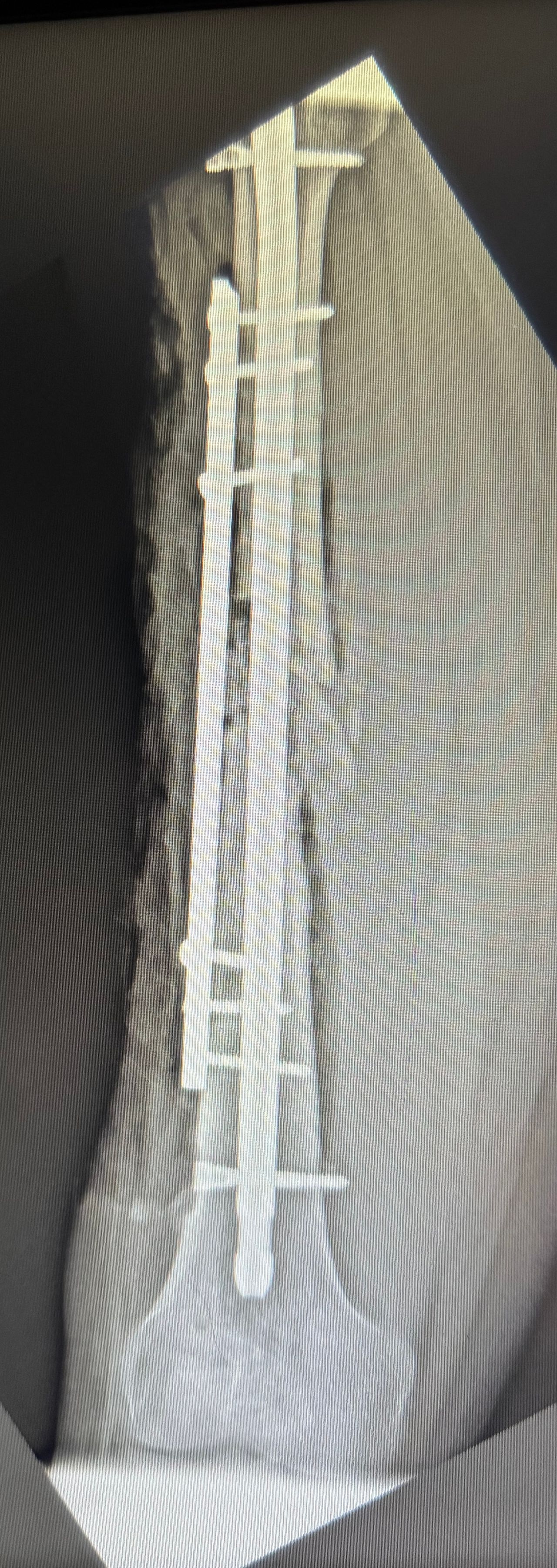 Ana Judith Jhotzely Lozano Reyes-3