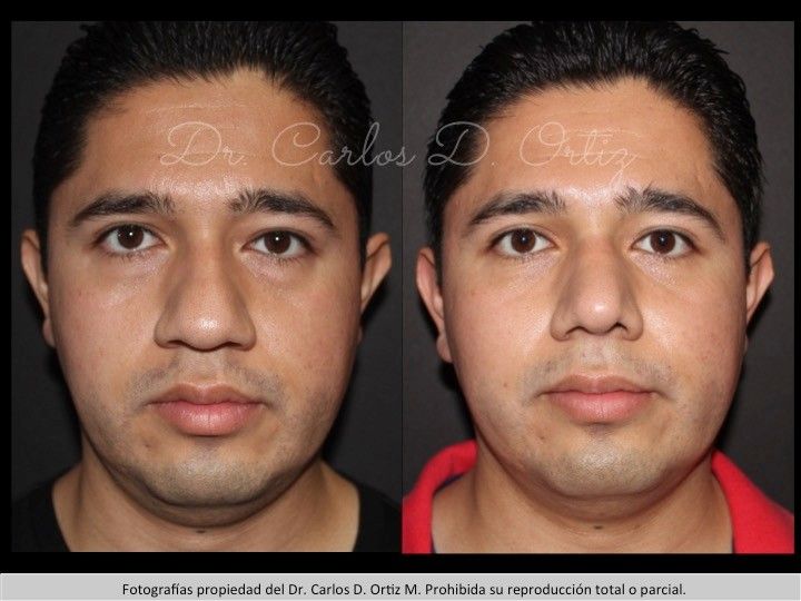 Carlos David Ortiz Moreno-47