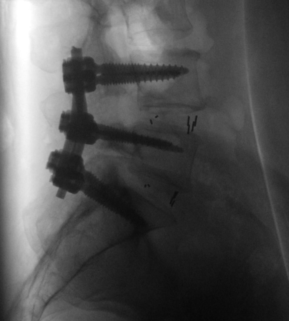 Lino Iracheta Silva-7