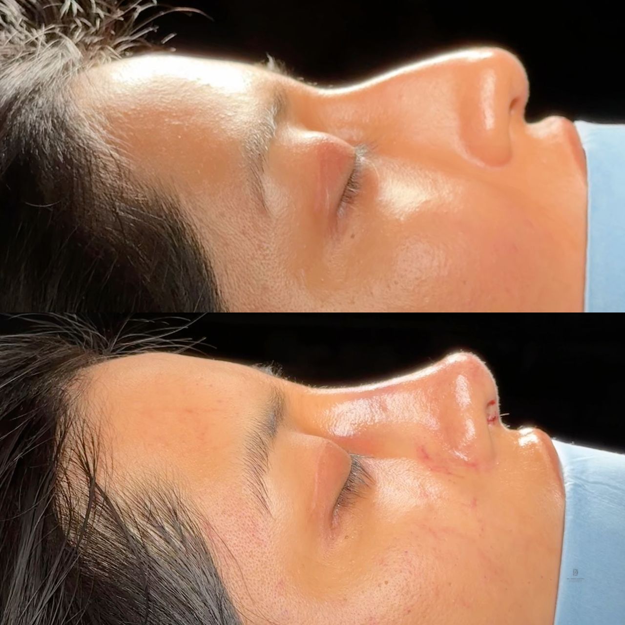 Angel Castro Urquizo-223