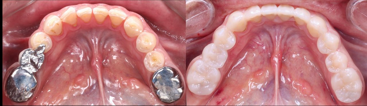 Alexandro Castrellon-5