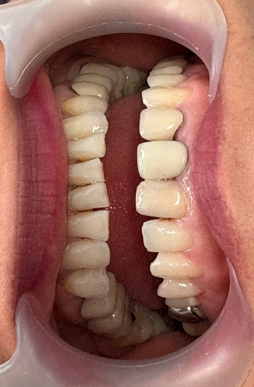 Arturo Romero Grande-26