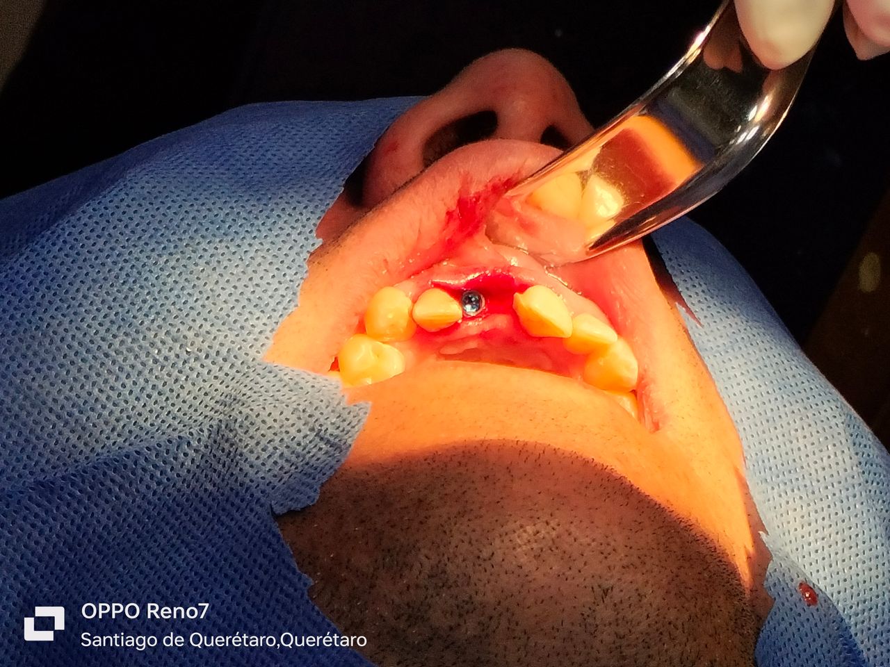 Yaneth Gutiérrez Sánchez-37