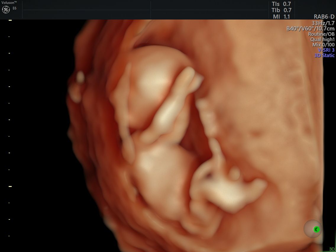 Gila Lili Barrientos Chavez-1