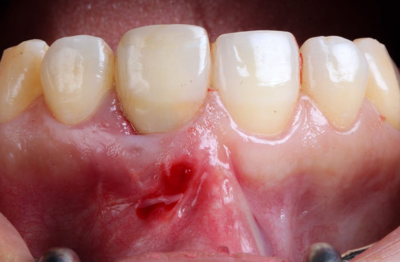 Hugo Enrique Aguilar Lamas-19