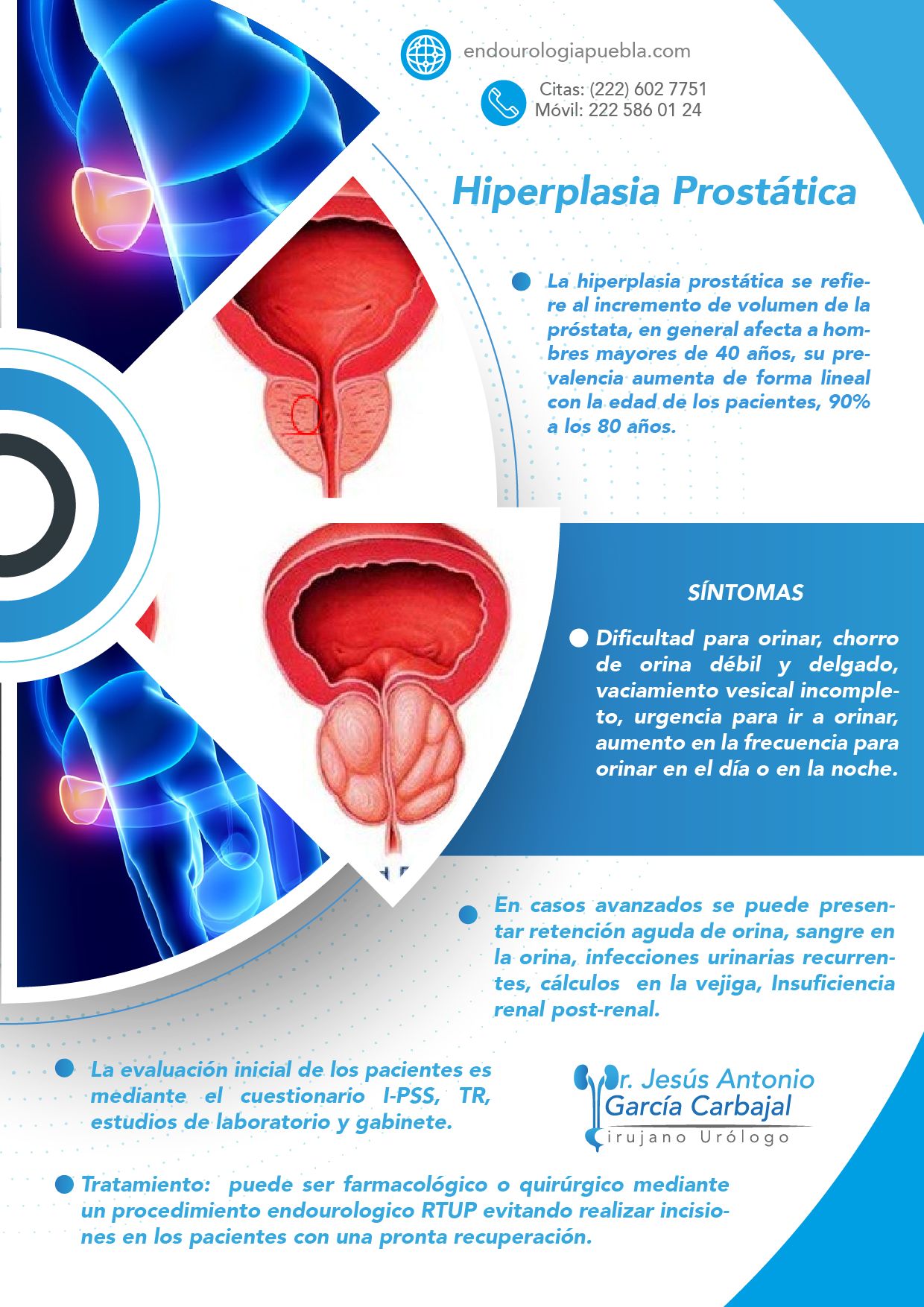 Jesús Antonio García Carbajal-6