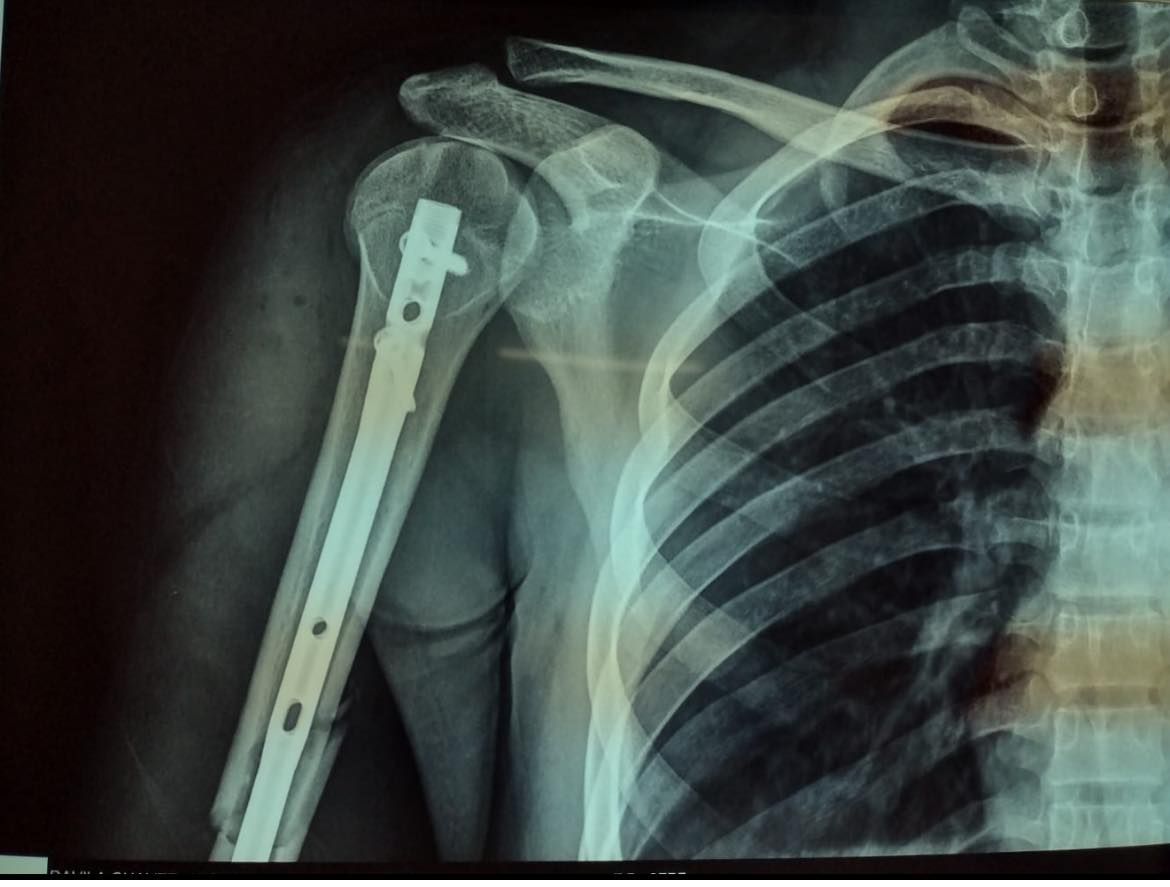 Felix Alfaro Arias-9