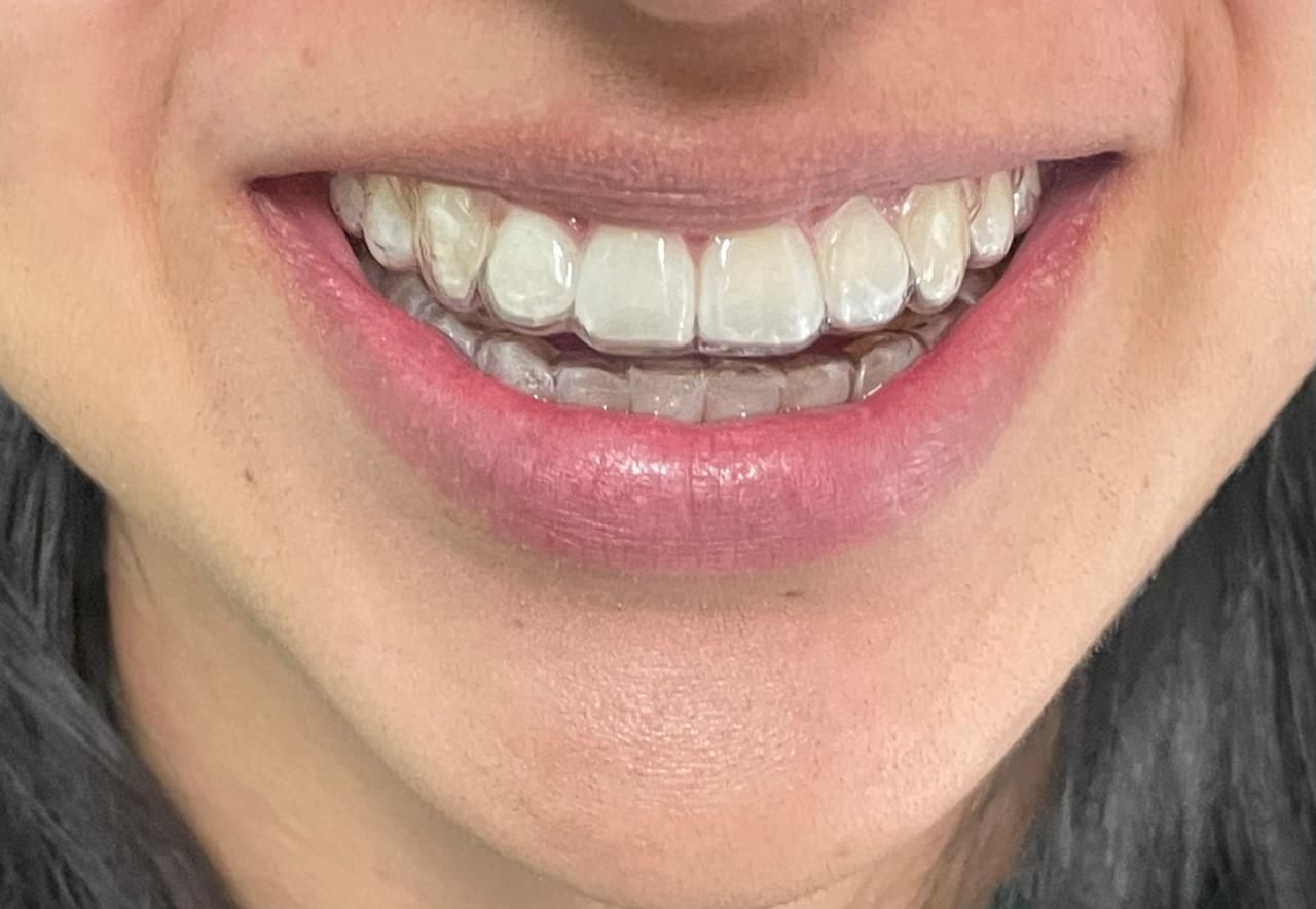 Anuar Becerril Castro-5