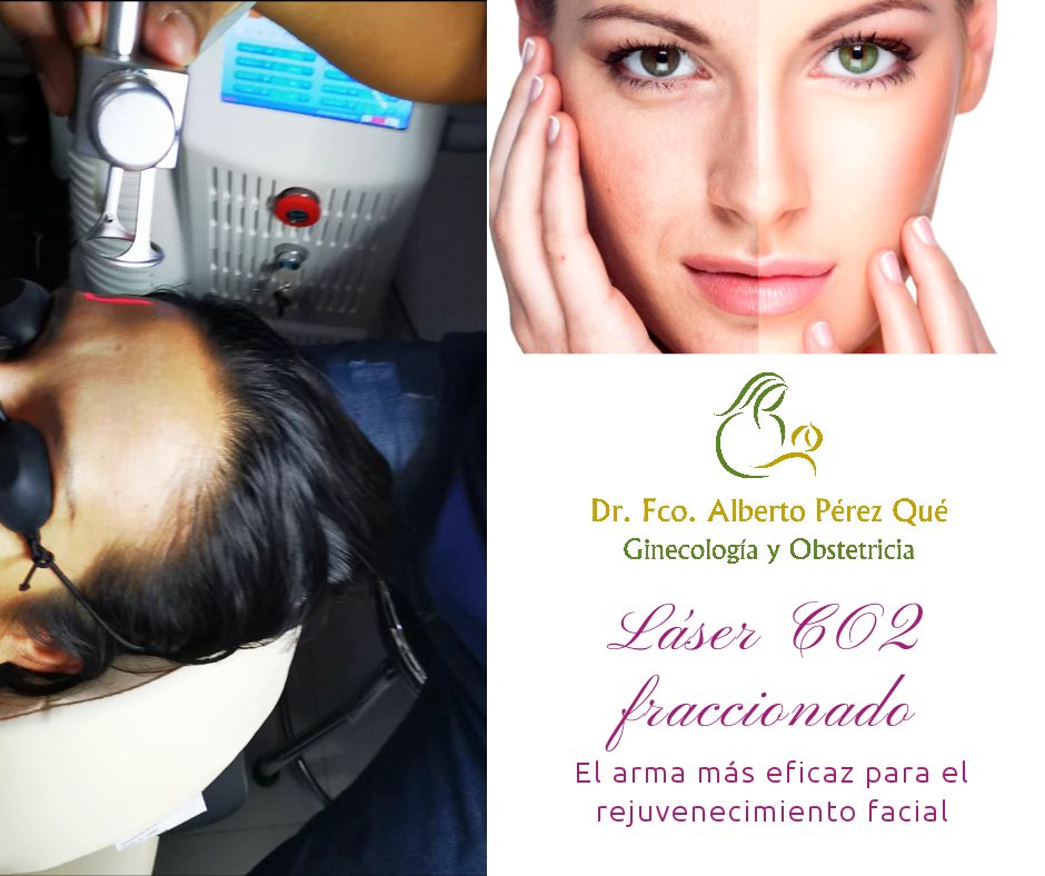 Francisco Alberto Perez Que-36