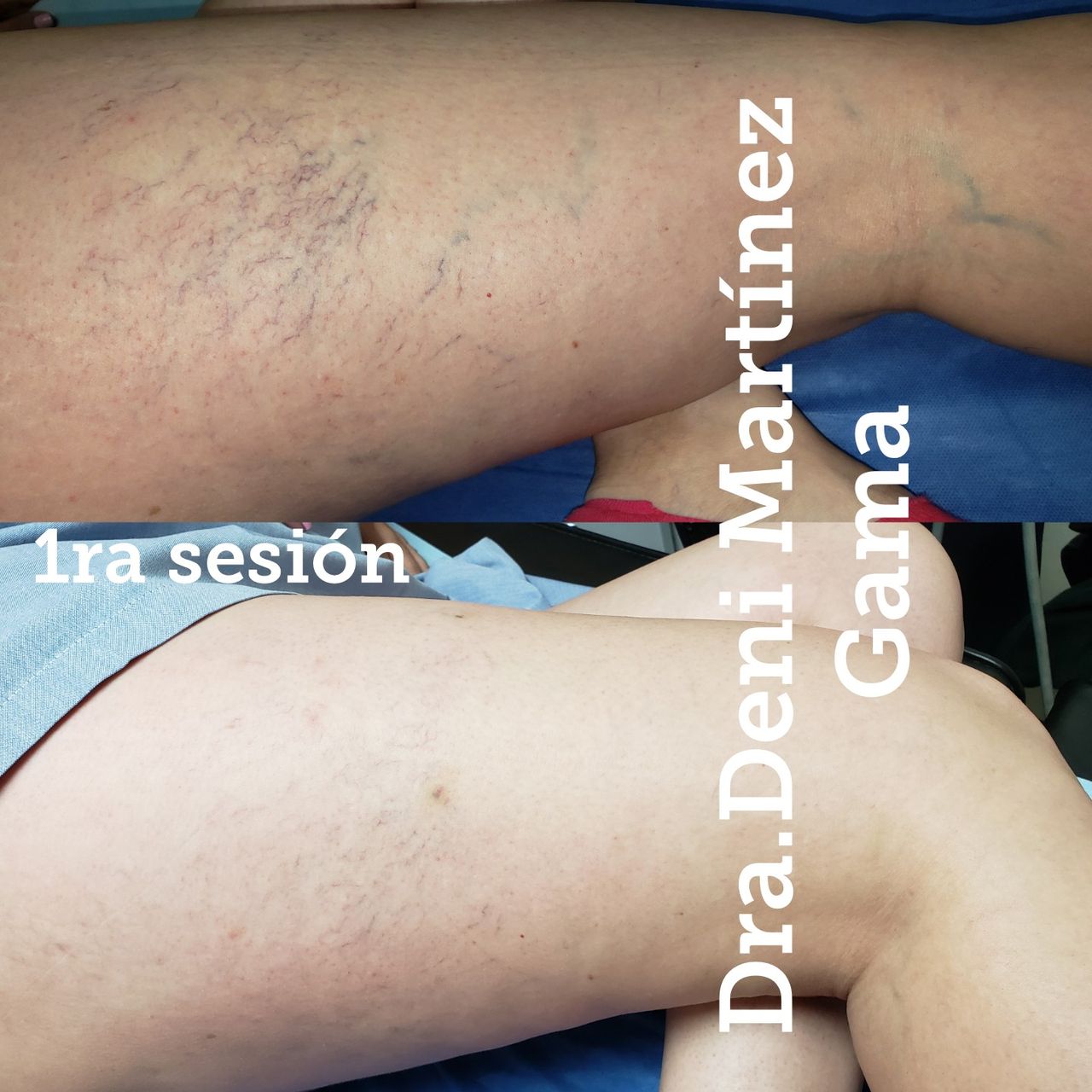 Deni Martínez Gama-17