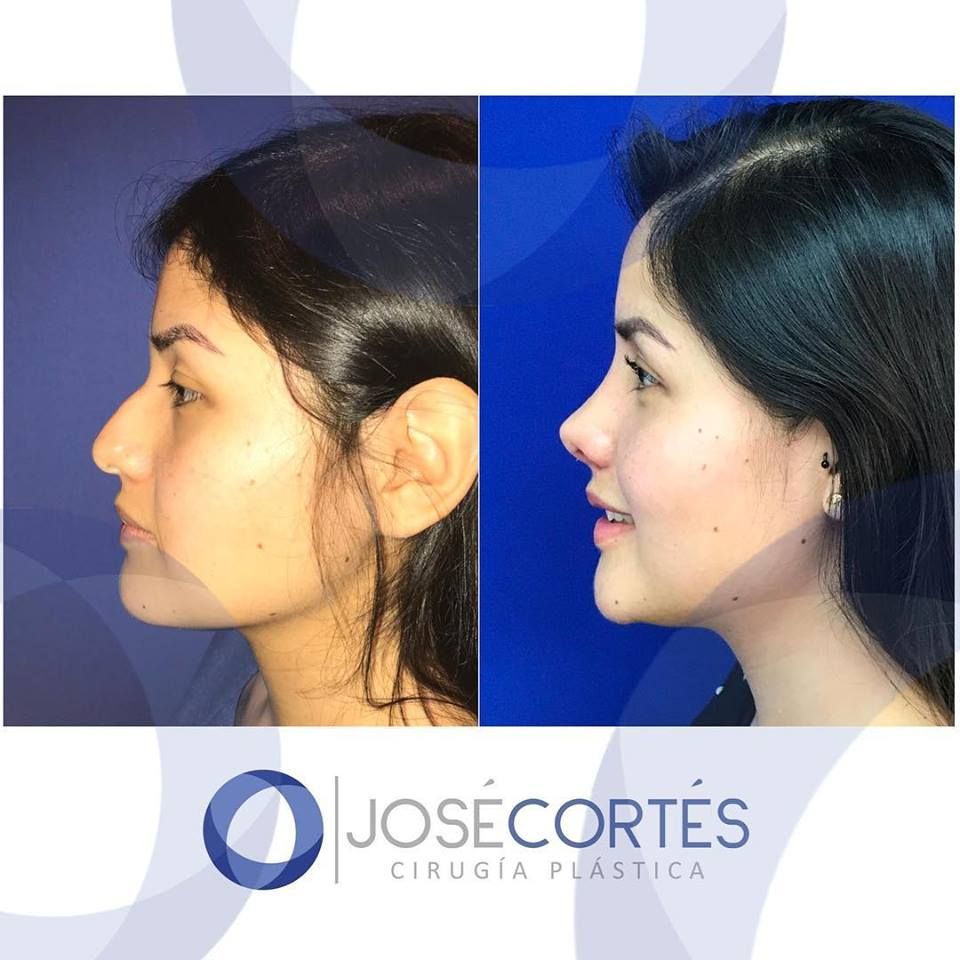 José Cortés Arreguin-15